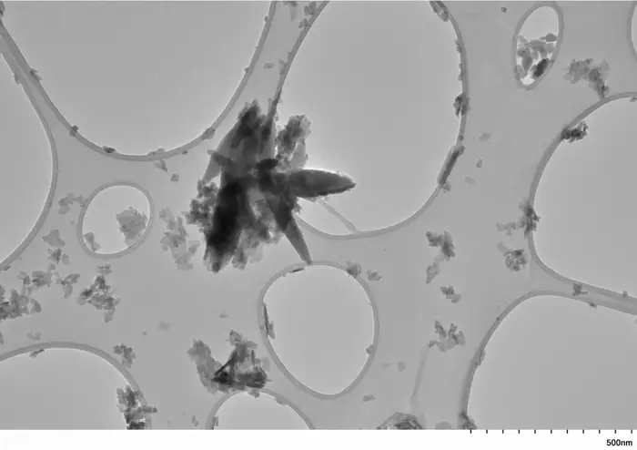Stroke patients have high levels of microplastics in the plaque clogging their arteries, researchers find