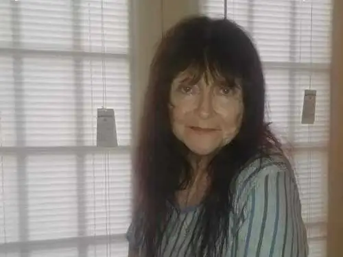 A boomer lost Medicaid because she gets $2,065 monthly from Social Security. Now she needs to work to afford back surgery.